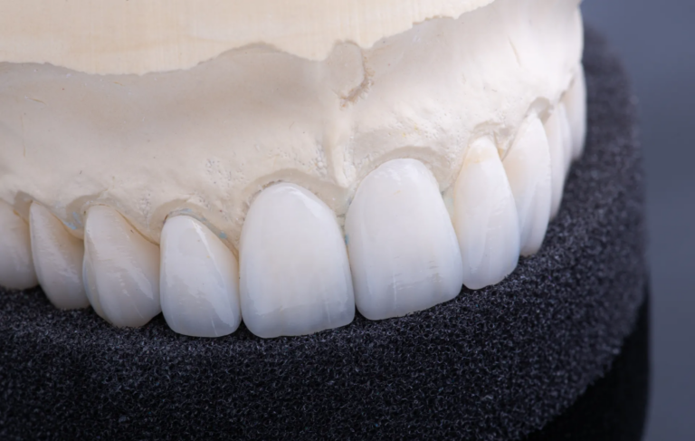 Crafting Ceramic Crowns: A Wichita Dental Lab That Delivers